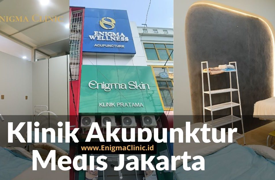 Klinik Akupunktur Medis Jakarta dengan Pendekatan Aman dan Profesional